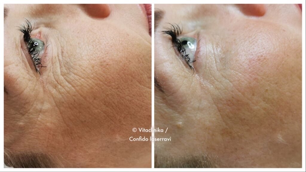 OxyGeneo TP+Revive+US Lithuania 1