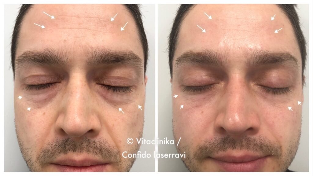 OxyGeneo TP+Revive+US Lithuania 2